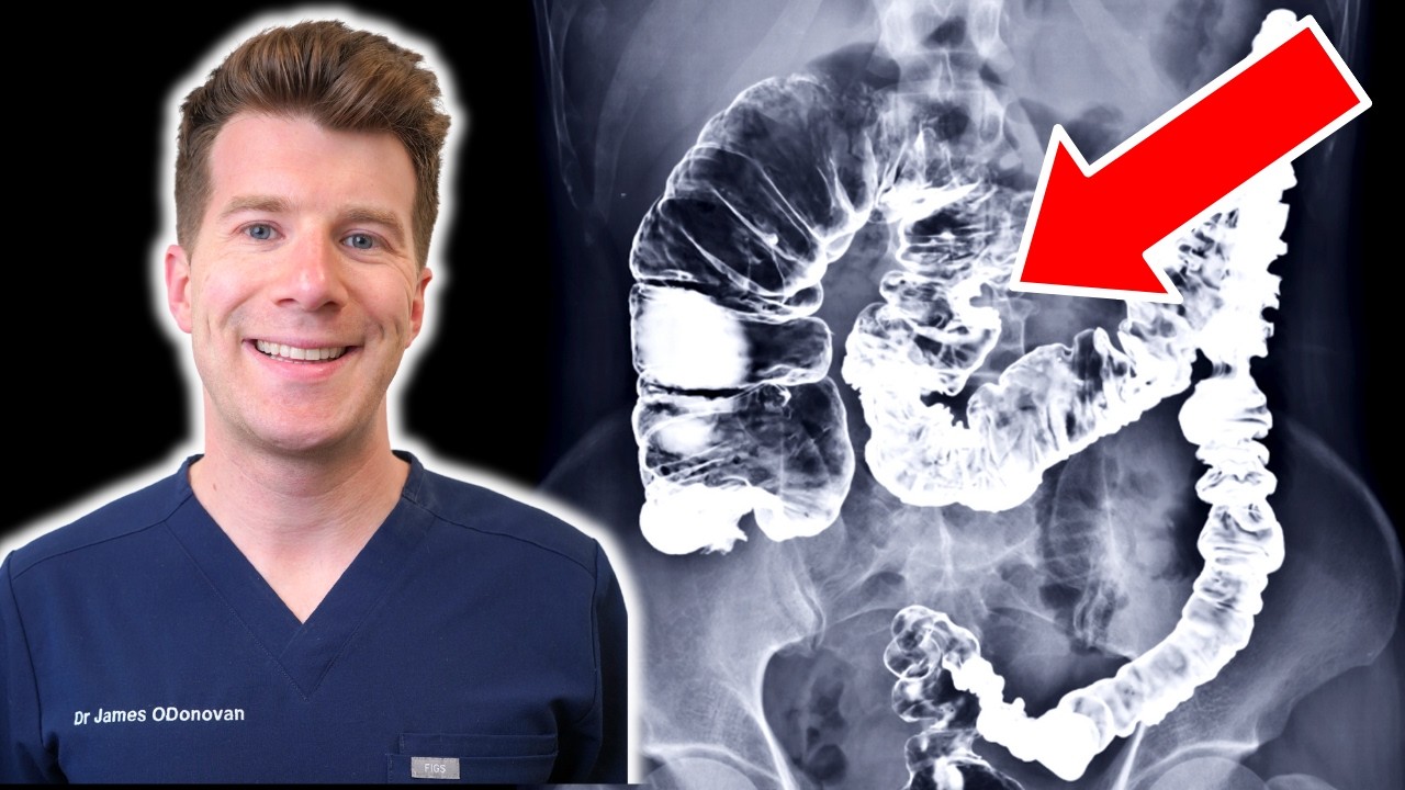 Barium Enema: A Guide to This Colon X-Ray Test