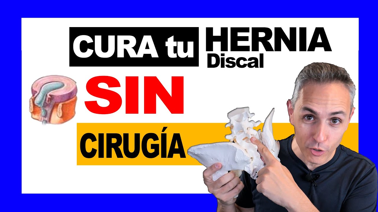 ✅cómo Curar una HERNIA Discal SIN cirugía ❌