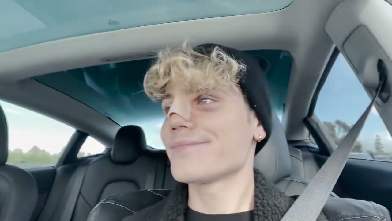 Nicky got a nose job *THE REVEAL* | Nicky and Pierre #NiPi (Part 2)