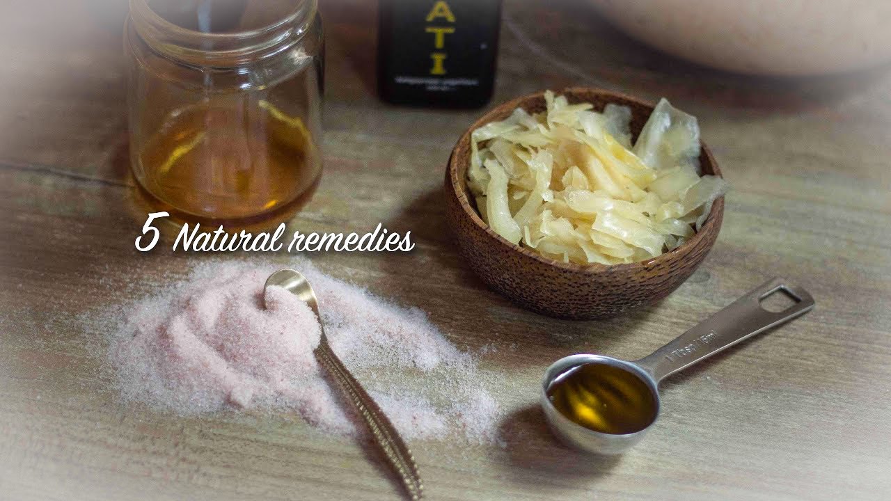 NATURAL POLLEN ALLERGY REMEDIES | How to get rid of hayfever and allergy symptoms