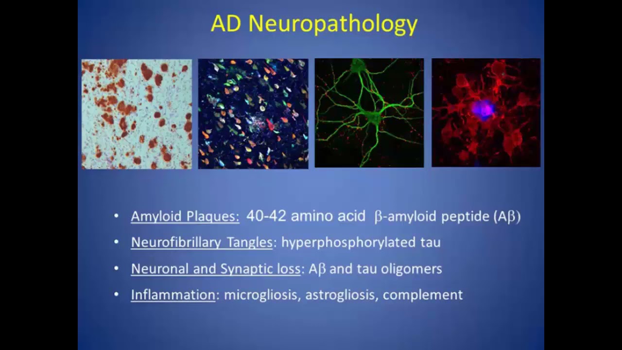 Generation and Use of iPSC derived Microglia to Study Neurodegenerative Diseases