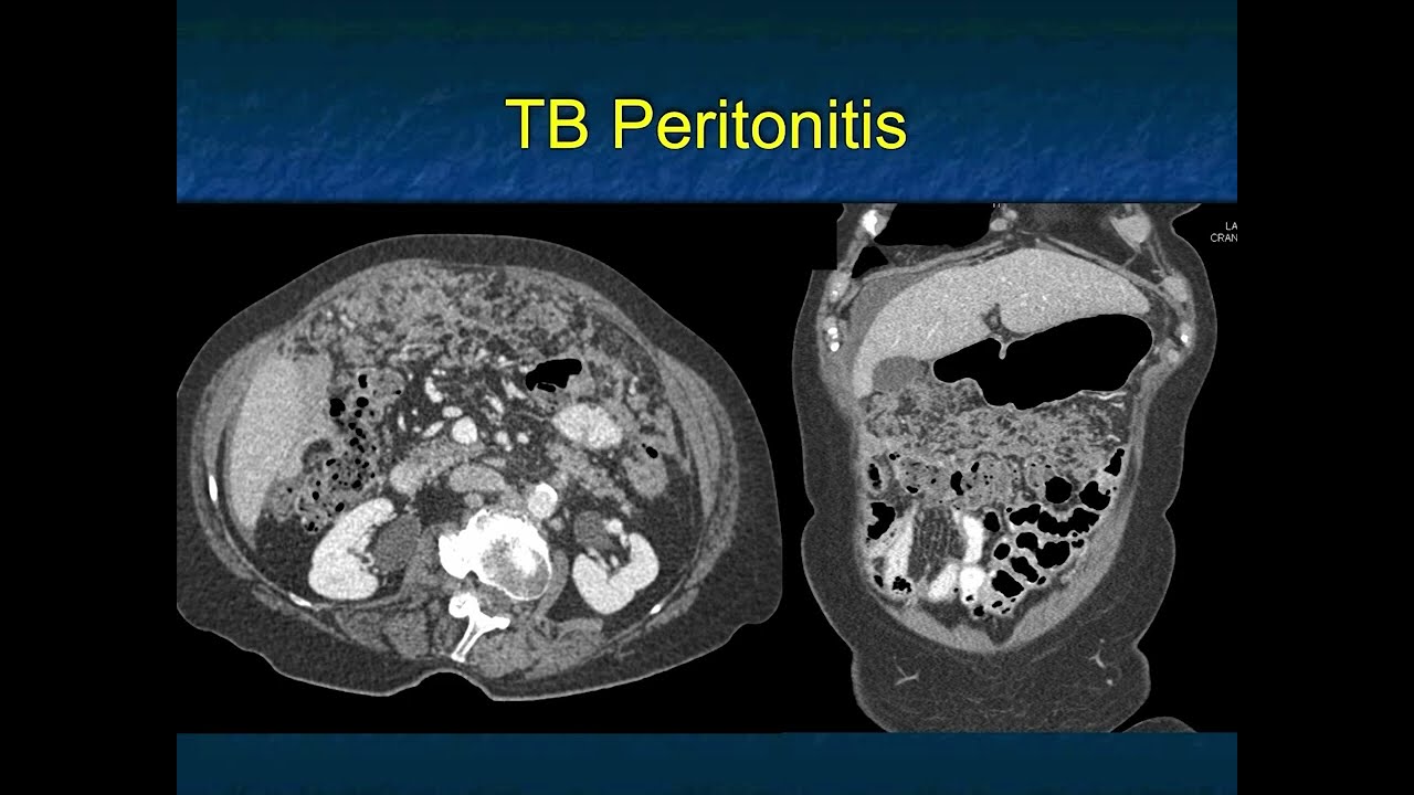 You Make the Call! Freestyle Radiology Quiz #19