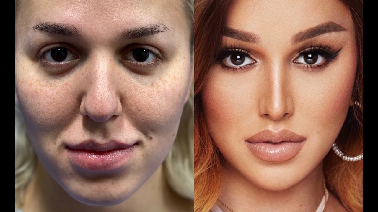 My Facial Feminization Surgery Part 2 | La Demi