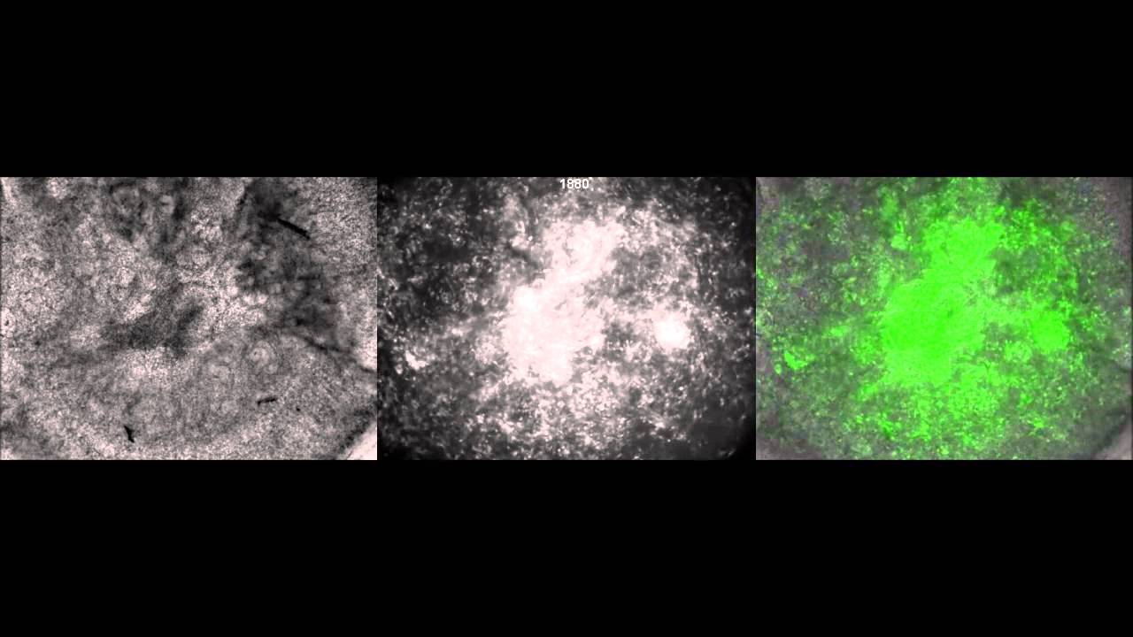 Functional Genetic Targeting of Embryonic Kidney Progenitor Cells Ex Vivo