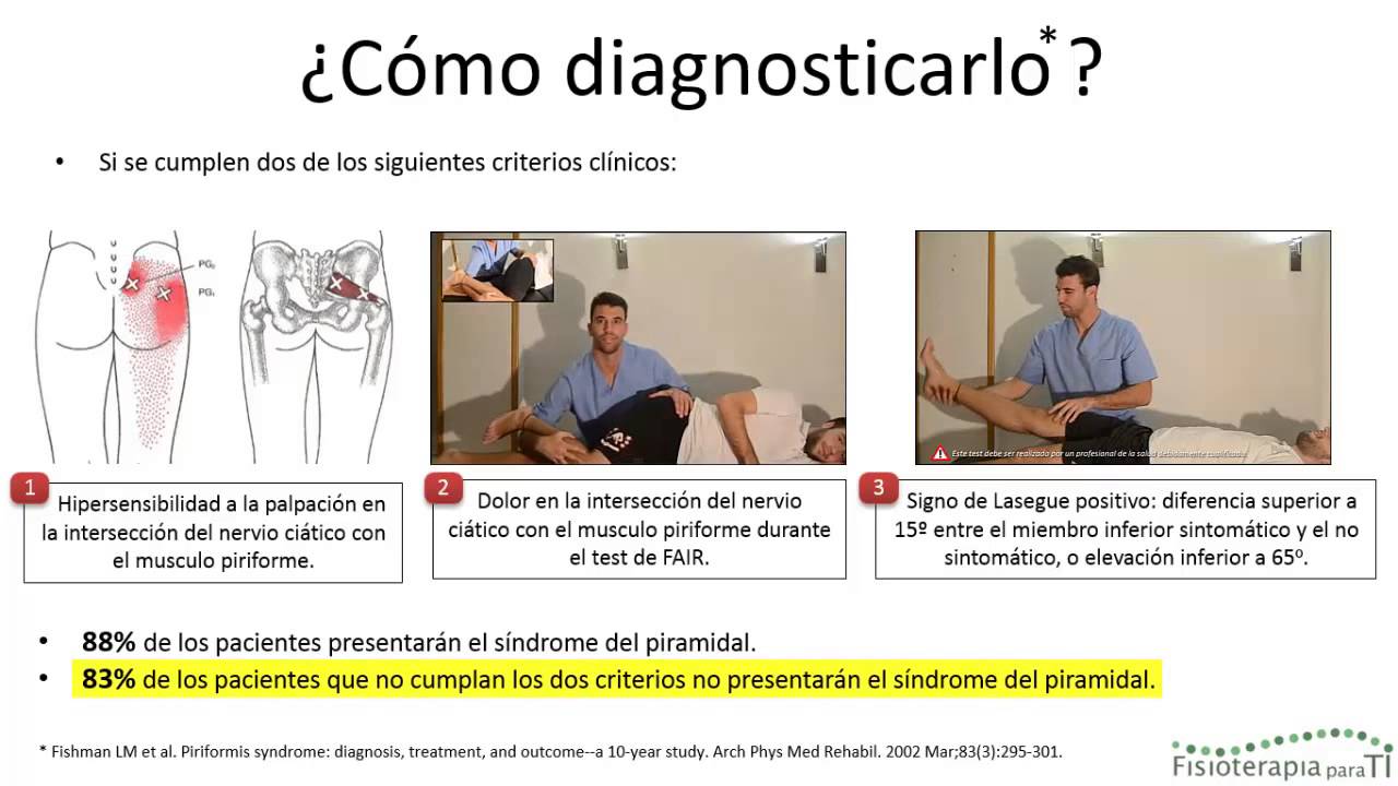 Síndrome del piramidal o 