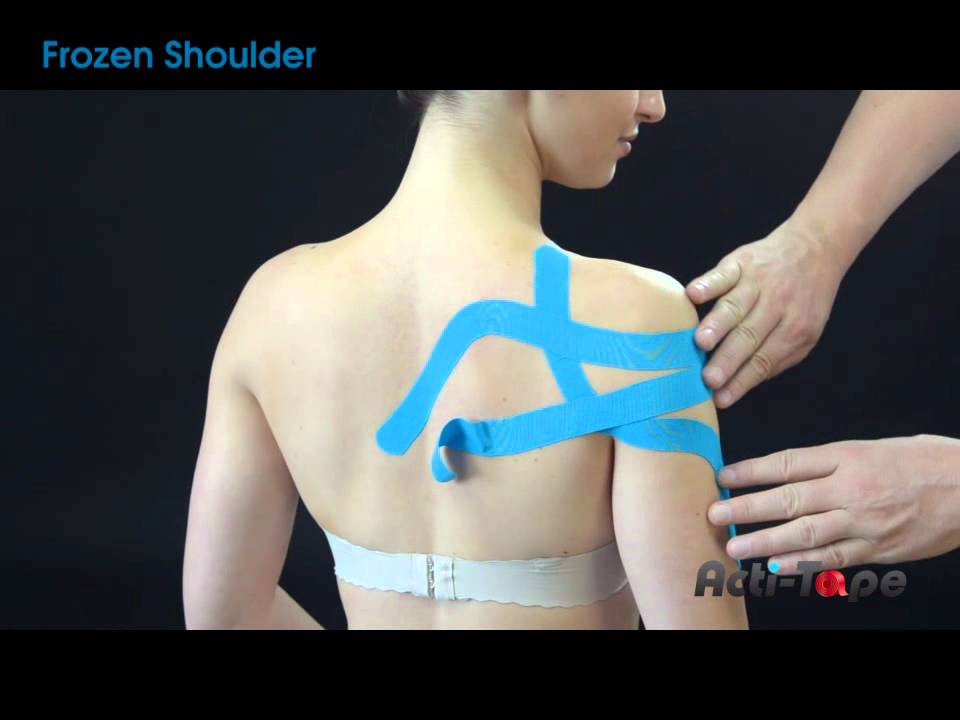 Acti-Tape - Frozen Shoulder