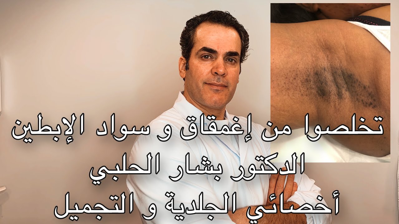 خمس نصائح ذهبية للتخلص من الإسوداد و الإغمقاق في منطقة الإبطين - طبيب جلد و تجميل