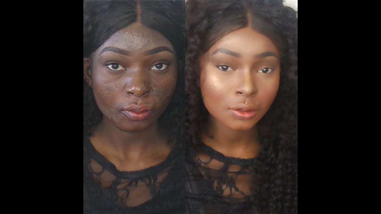Cover Up Acne & Burn Scar - Highlight And Contour Tutorial