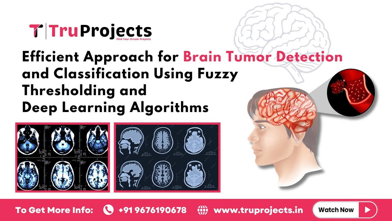 Efficient Approach for Brain Tumor Detection and Classification Using Fuzzy Thresholding and Deep Le