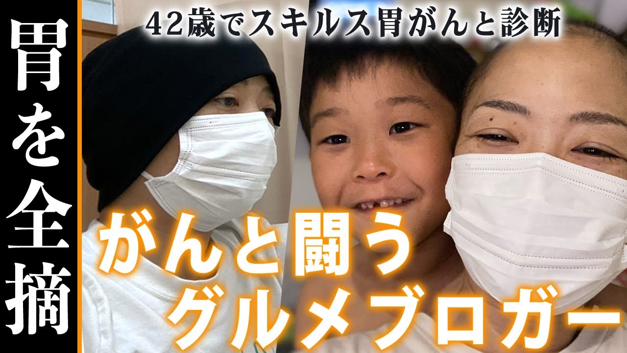 【闘病】何気ない違和感から発覚したスキルス胃がん～副作用がきつくても乗り越えられた理由～