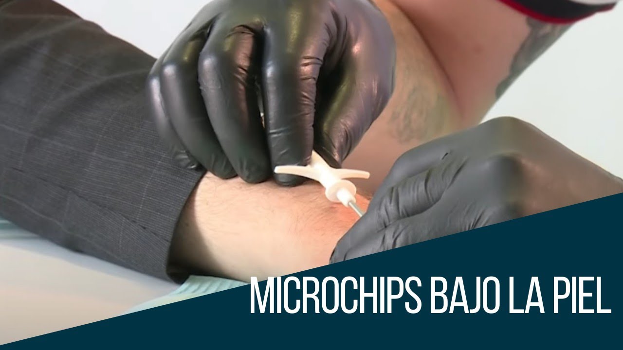 Conozca porqu&eacute; personas en todo el mundo se est&aacute;n implantando microchips
