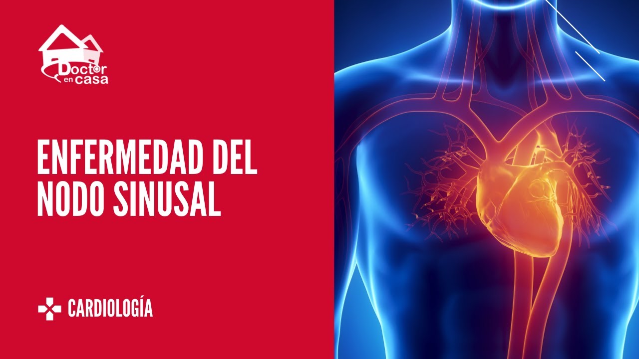 Enfermedad del nodo sinusal