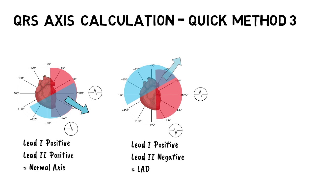 QRS AXIS CALCULATION