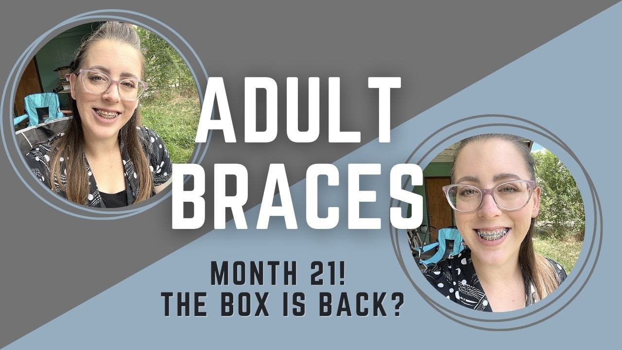 Adult Braces Month 21 | The Box Is Back! | Almost Done With Treatment? | Ortho Appointment