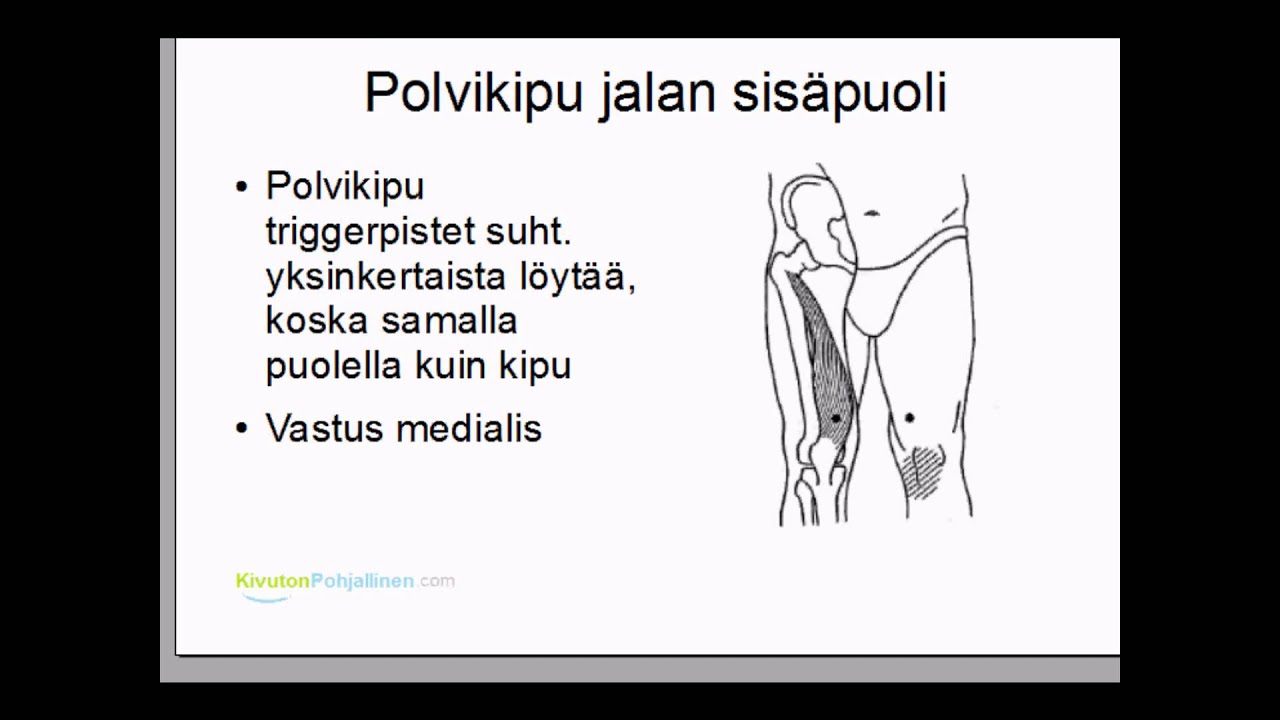 Polvikipu-101 itsehoito triggerpistehieronta