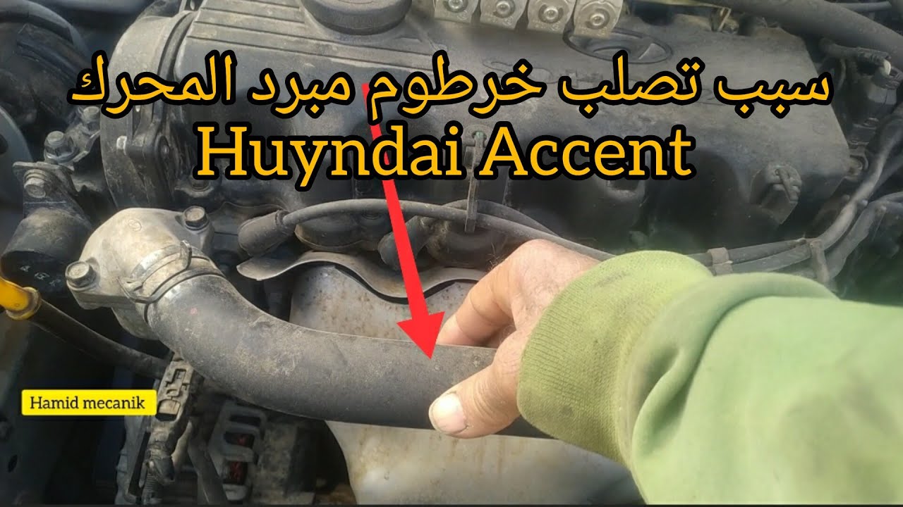 سبب قساوة خرطوم سائل التبريد Huyndai Accent 1.5 essence