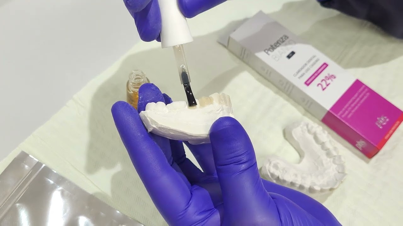 Dica para confecção de Placa para Clareamento Dentário caseiro