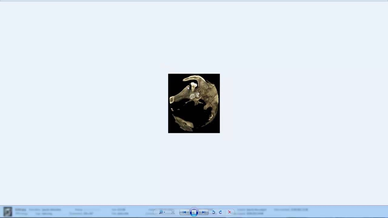 Molar de minte impins spre ATM 2