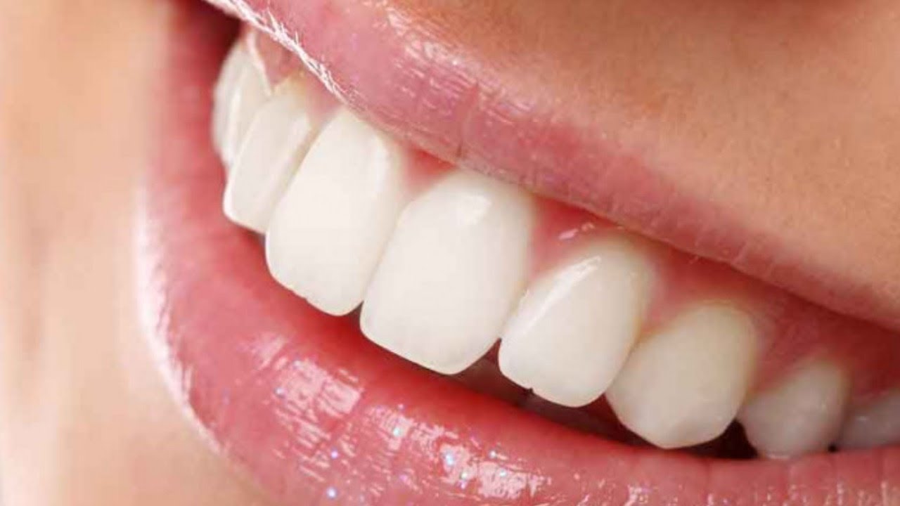 Aarogyadarshini : Preventing and Treating Common Dental Problems