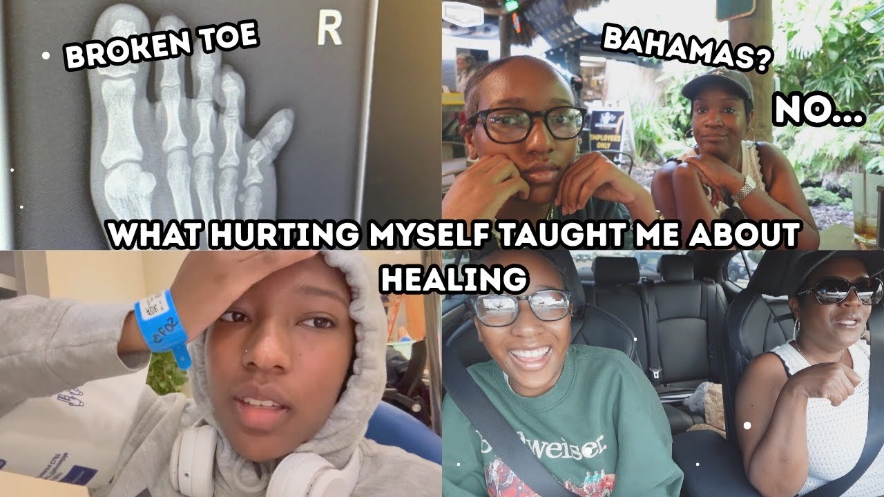 chaotic summer diaries: I BROKE MY TOE!