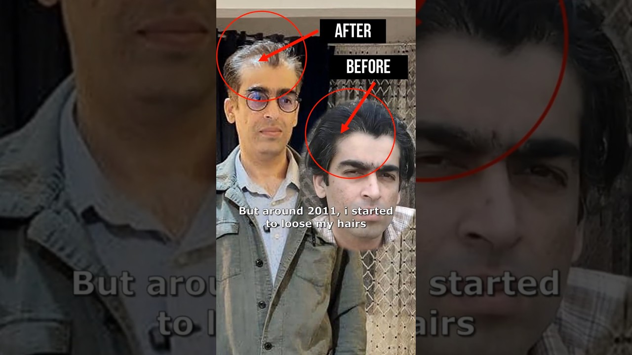 Syed Muhammad Qasim bin Abdul Kareem hair regrowth and height increase #muhammadqasimdreams