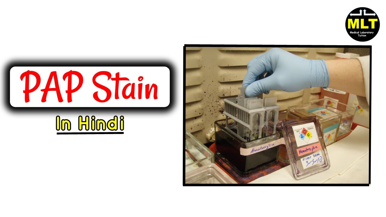 Pap stain procedure in cytology || Pap stain principle and procedure in hindi
