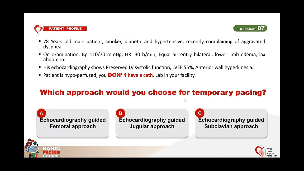 CASE BASED SCENARIOS Indications for Cardiac Pacing  Dr Hany Samir ASSAAD Egypt