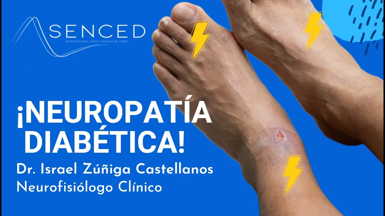 NEUROPATÍA DIABÉTICA