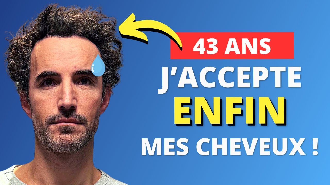 Calvitie, Cheveux frisés - j'accepte ENFIN mes cheveux .. à 43 ans 😅!