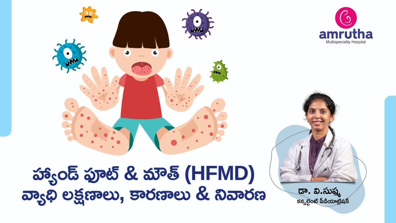 HFMD Hand, foot and mouth disease : Causes, Symptoms, Diagnosis & Treatment