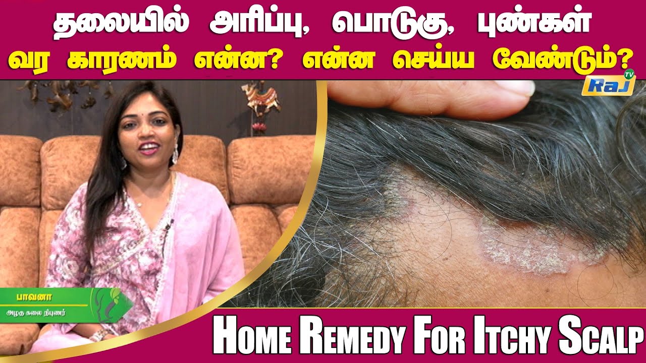 தலையில் அரிப்பு, பொடுகு, புண்கள் வர காரணம் என்ன? என்ன செய்ய வேண்டும்? | Home Remedy For Itchy Scalp