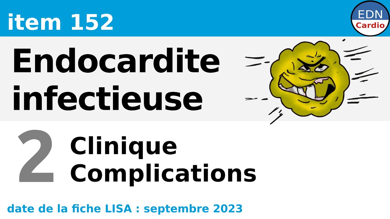 152 - Endocardite infectieuse - Partie 2 - Signes cliniques et Complications