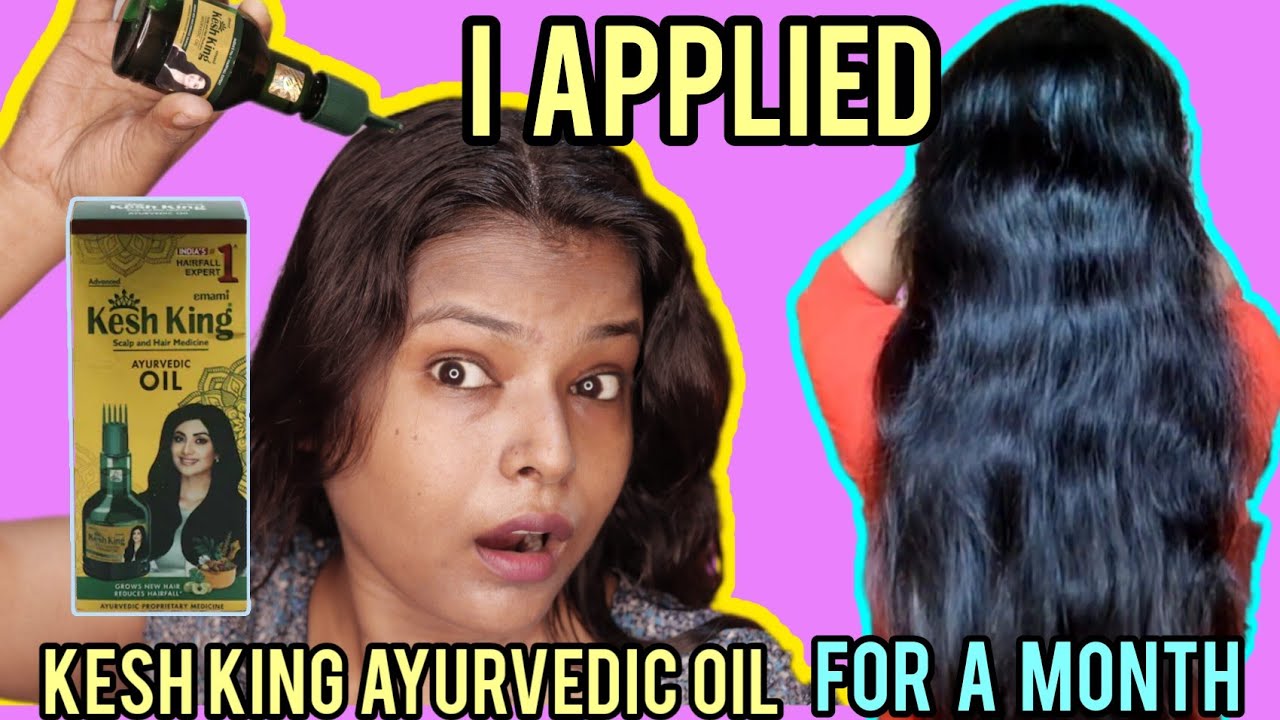 OMG I Applied KESH KING AYURVEDIC HAIR OIL For A Month | Kesh King Hair Oil Review | Shinny Roops