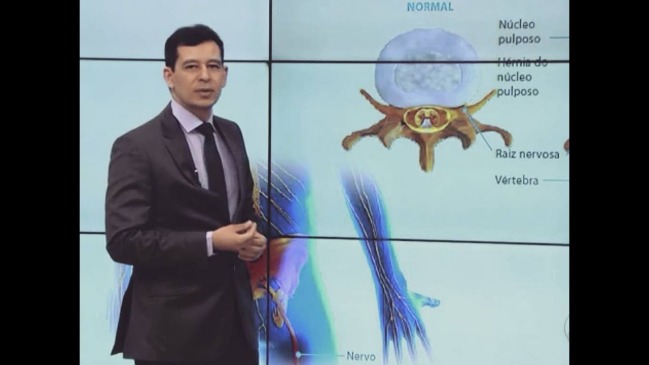 O neurocirurgião Emerson Magno fala sobre hérnia de disco e coluna vertebral