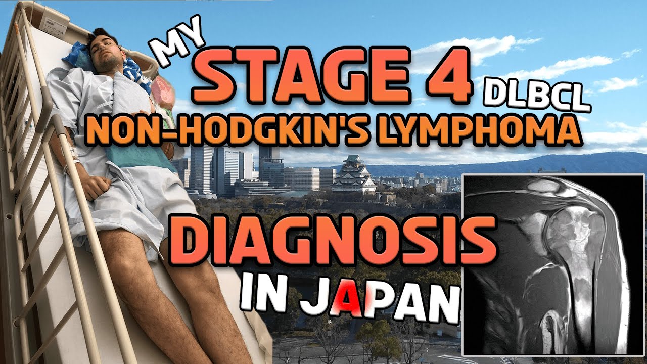 My Non-Hodgkin's Lymphoma Diagnosis Journey (Diffuse Large B-Cell Lymphoma)