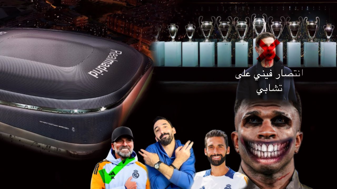 (اقاله تشابي الونسو ) القصه وما فيها 😳😳