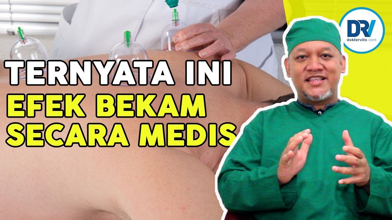 DOKTER BUKA RAHASIA ILMIAH TERAPI BEKAM !