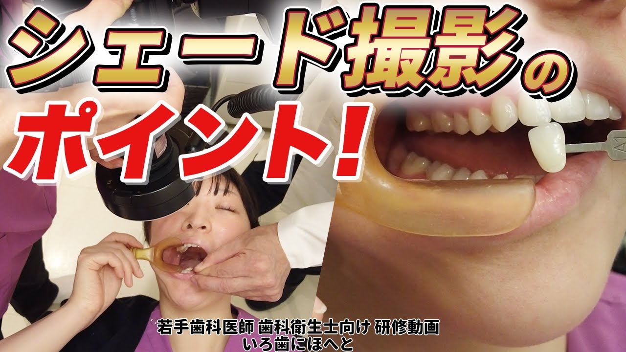 【シェード写真】撮影の仕方のポイント