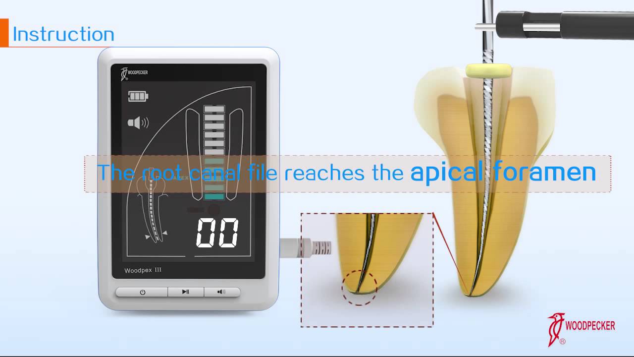 Apex Locator Woodpex III