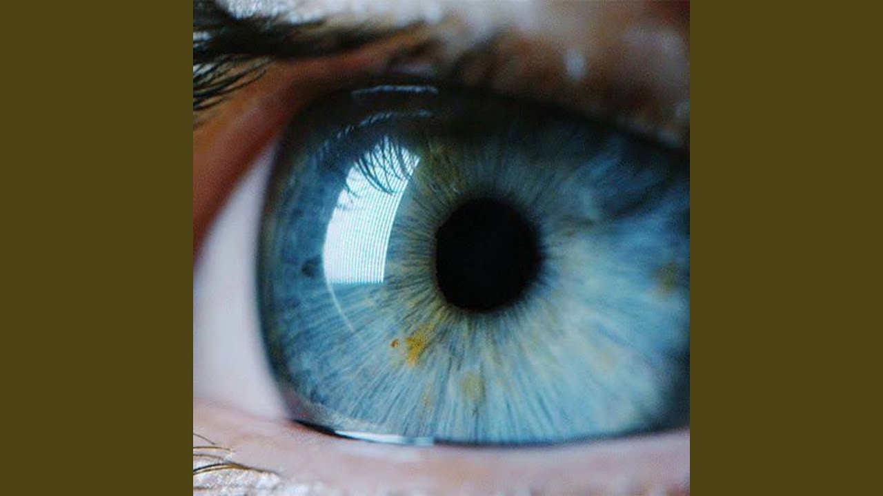 Vision