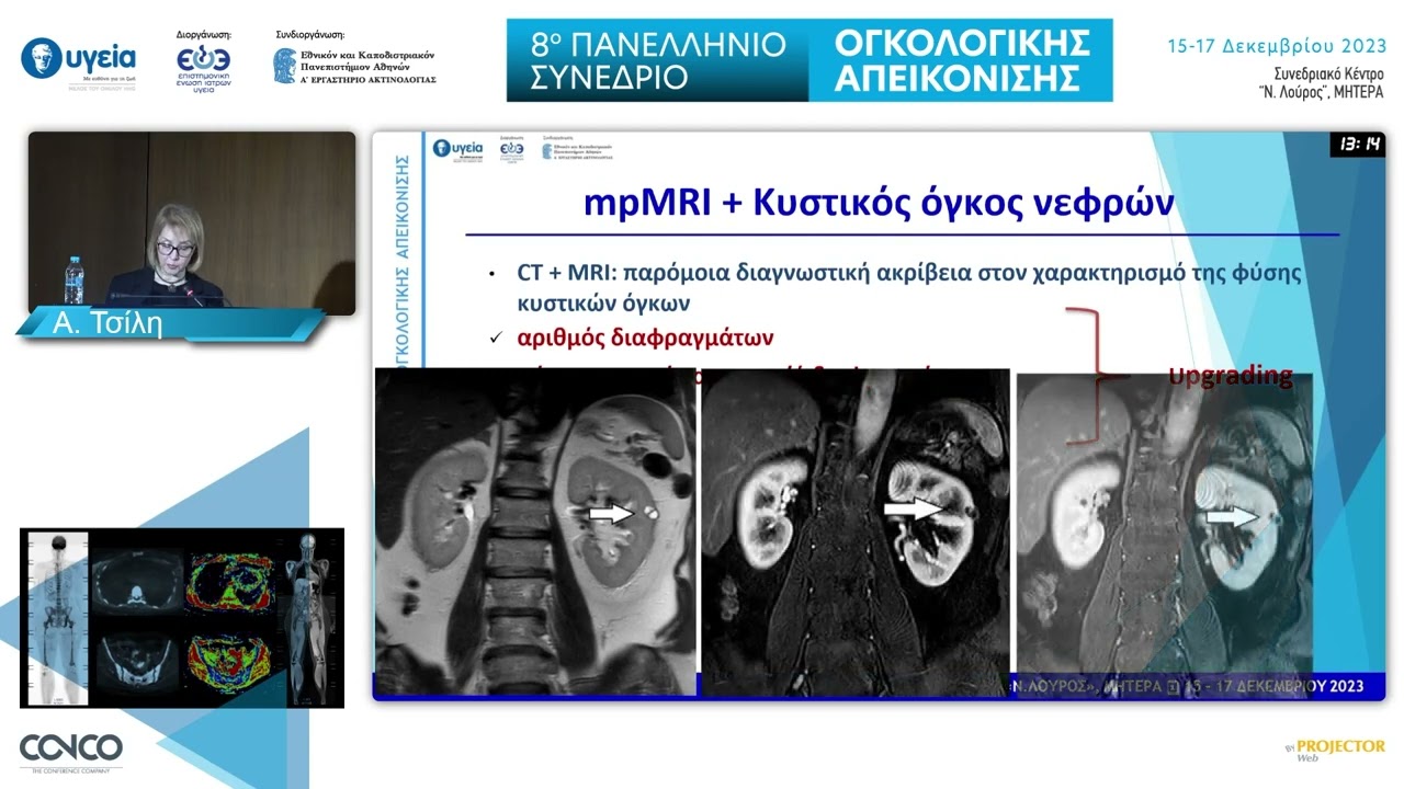 Όγκοι νεφρών