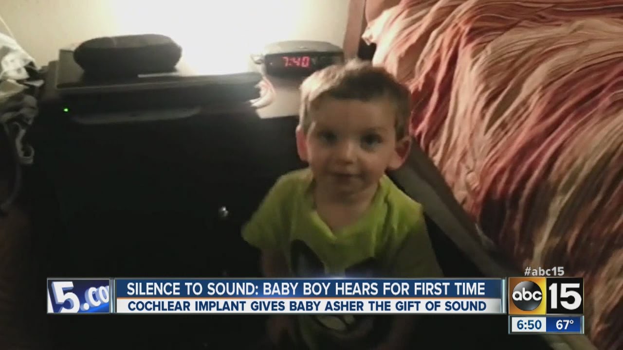 Cochlear Implant lets Valley boy hear for the first time
