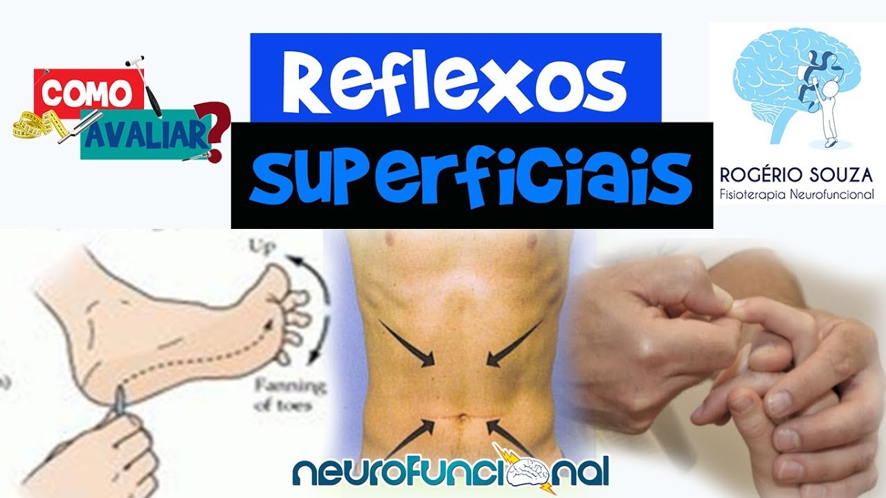 COMO AVALIAR REFLEXOS SUPERFICIAIS (Hoffmann, Cutâneo Plantar e Abdominal)