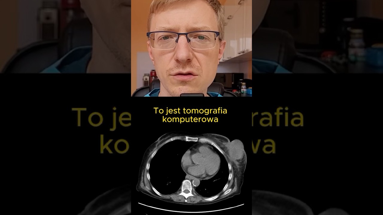 755. Tomografia komputerowa