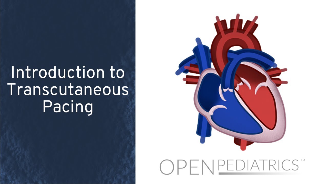 Introduction to Transcutaneous Pacing by M. Mazwi | OPENPediatrics