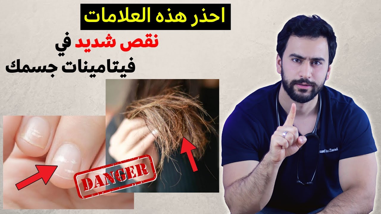 رسائل مهمة من جسمك تخبرك أنك تعاني من نقص فيتامينات شديد! انتبه لهم!
