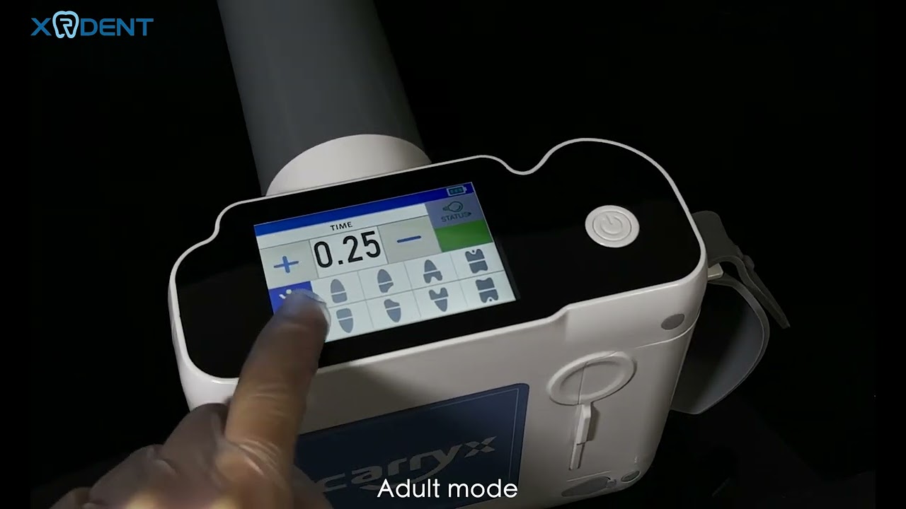 2023 The latest portable dental X-ray machine&mdash;&mdash;Carryx-III