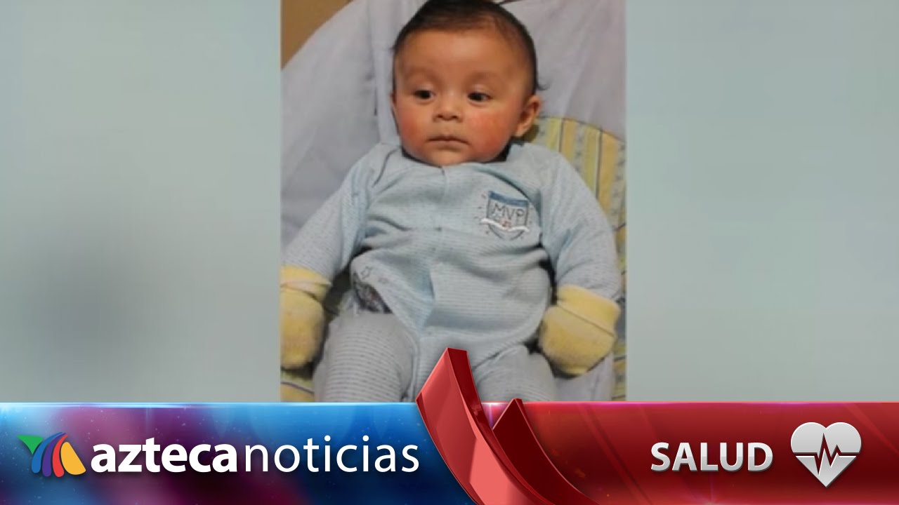 ¿Cómo afecta la dermatitis atópica a tú bebé?