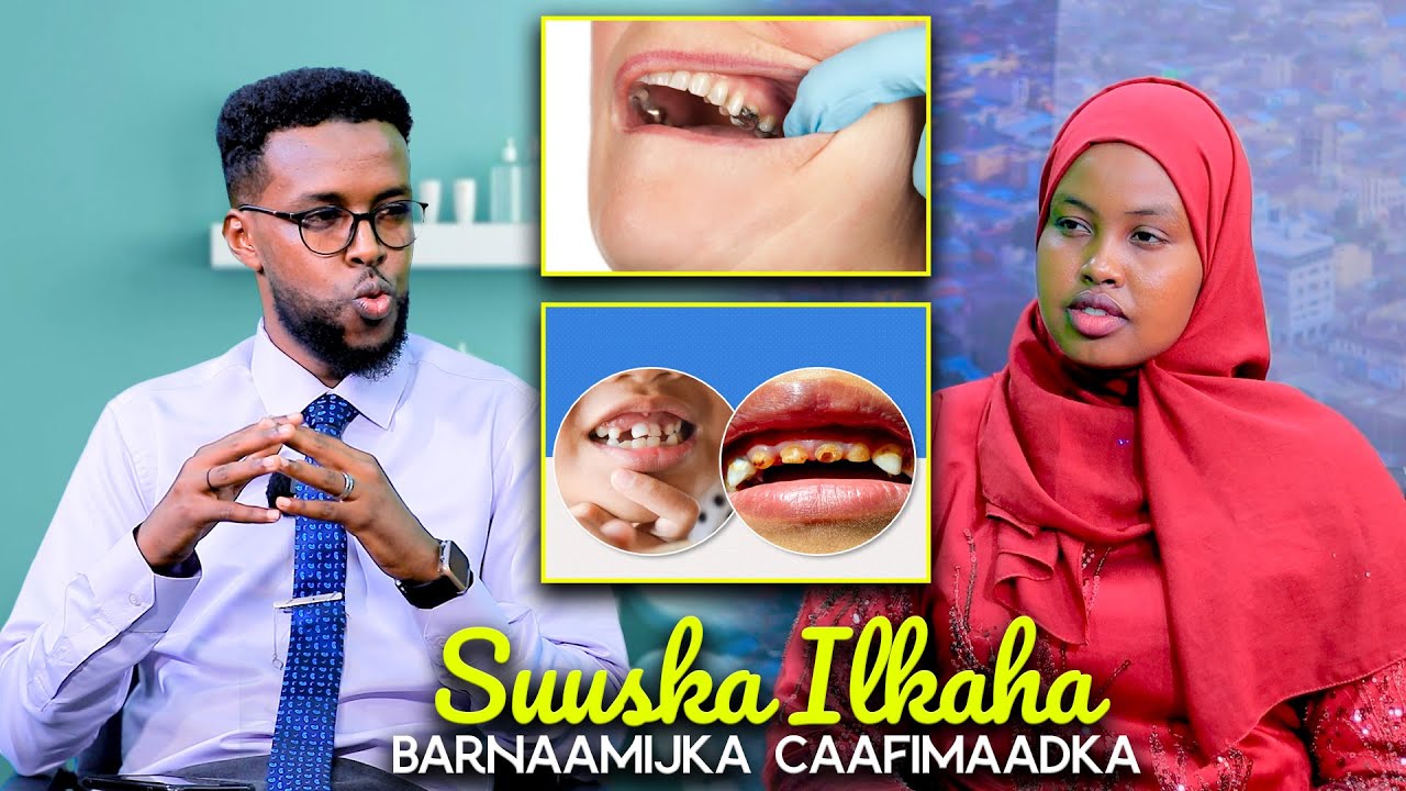 Waxyaabaha keena Suuska Ilkaha ku dhaca | Dr: Cabdiraxmaan Maano iyo Barnaamijka Caafimaadka.