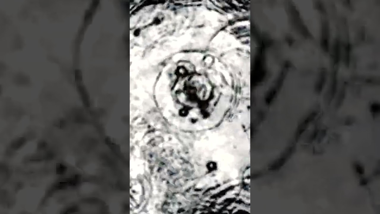 CEREBRAL DETOX: Continuous Raindrops